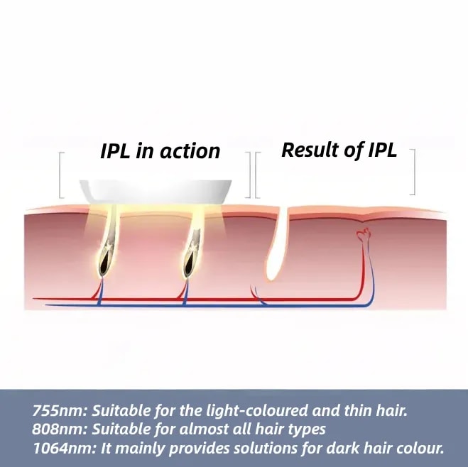 HOW IPL_WORKS